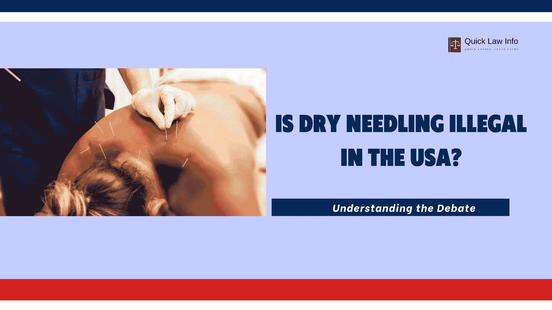 Is Dry Needling Illegal
